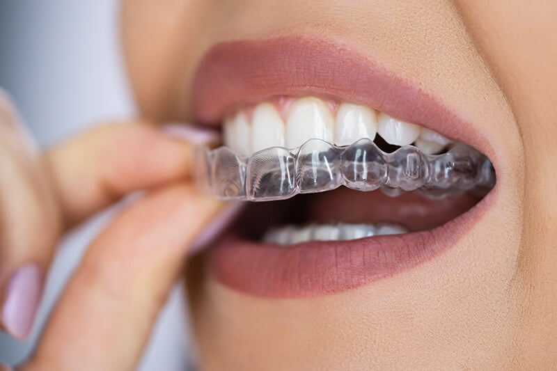 Endodonție Dental France