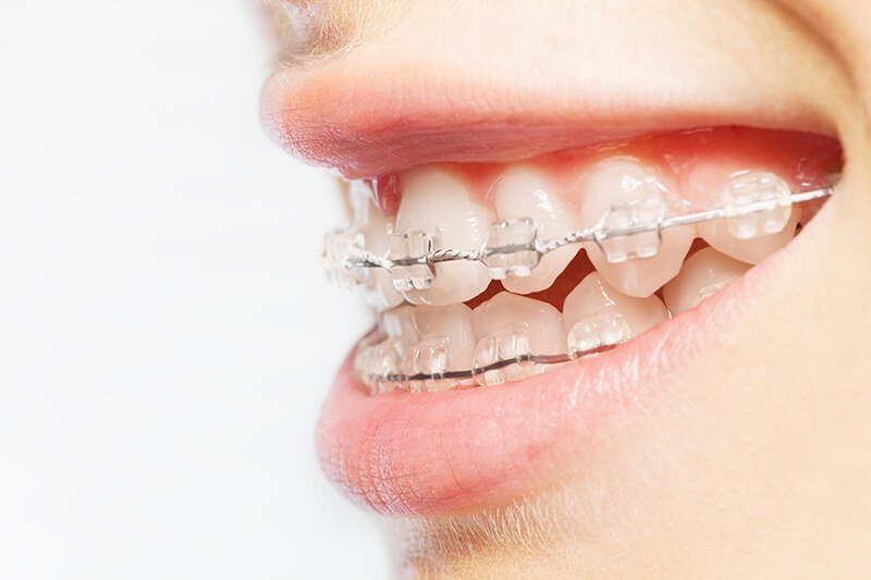 Endodonție Dental France